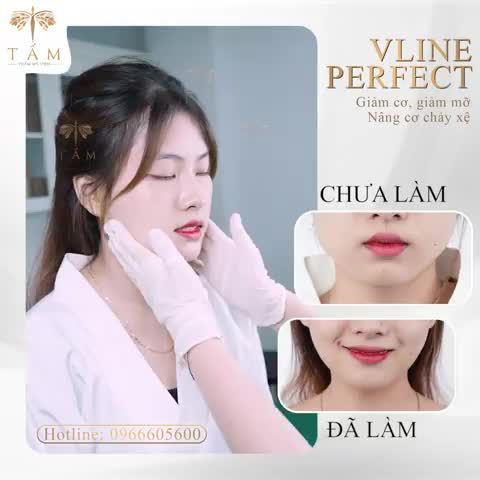 Khách hàng Khánh Linh đặt lịch đến Tấm tư vấn dịch vụ Vline Perfect