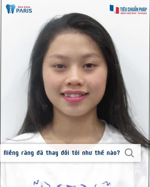 “Trong đầu có tri thức và bên ngoài có sự xinh đẹp thì còn sợ gì thử thách” Kiến tạo vẻ đẹp của sự tự tin sau 2 năm nhờ niềng răng của cô sinh viên tốt nghiệp đại học Y tại nha khoa Paris