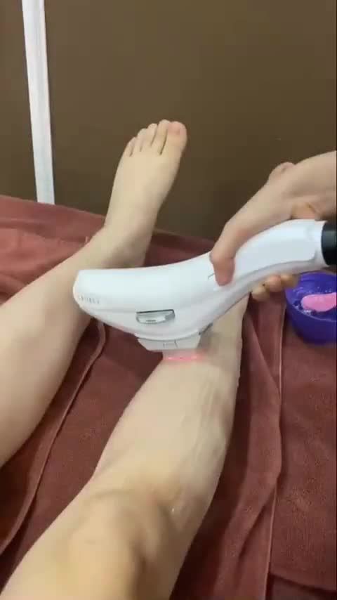 Triệt lông bằng công nghệ ánh sáng Elos tại Dr.Hải Lê 10 năm violong không mọc lại bạn có tin? Theo dõi ngay