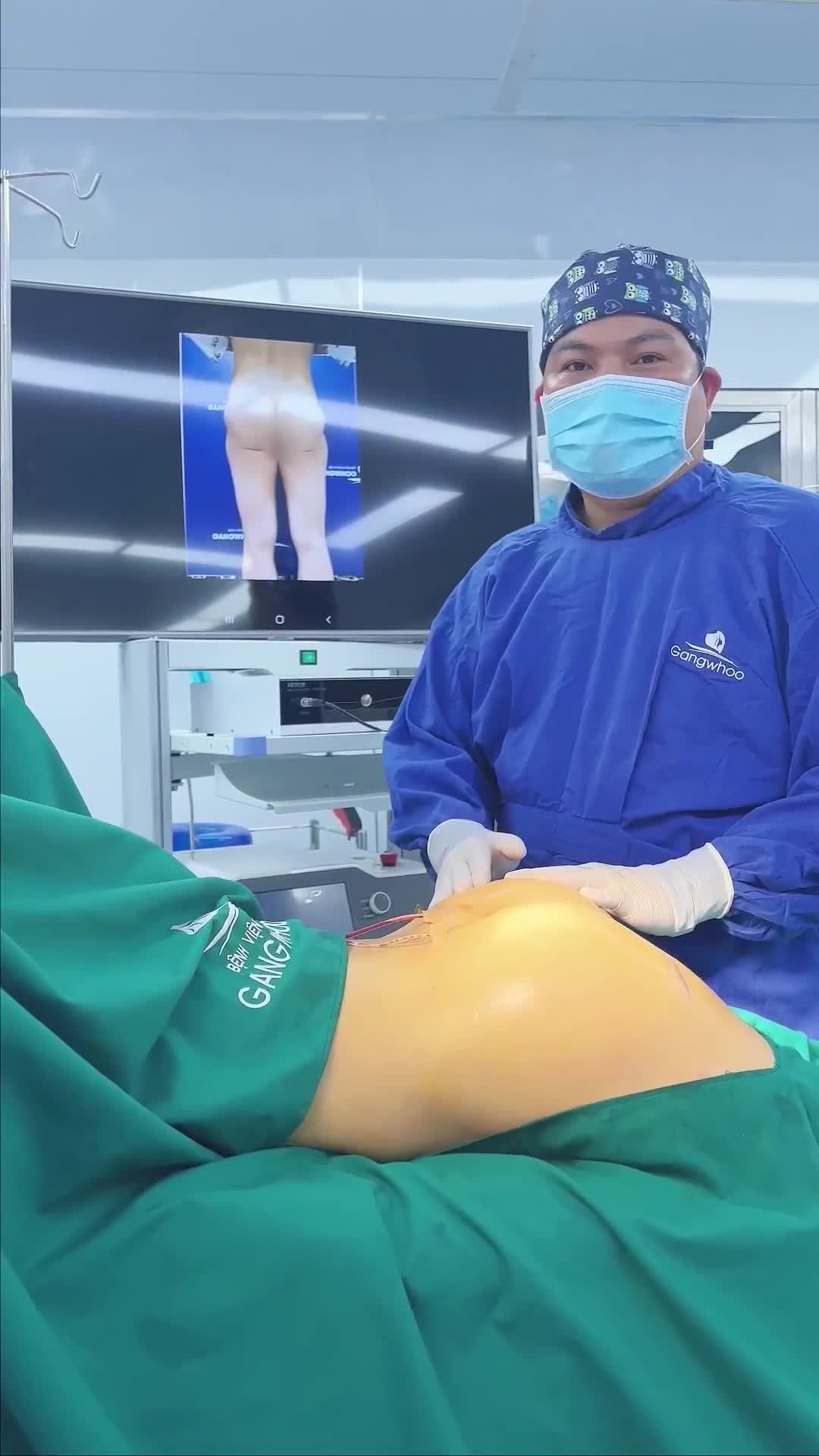 GIẢI CỨU VÒNG 3 BỊ VỠ TÚI DO NÂNG PHẢI TÚI KHÔNG ĐẠT CHUẨN