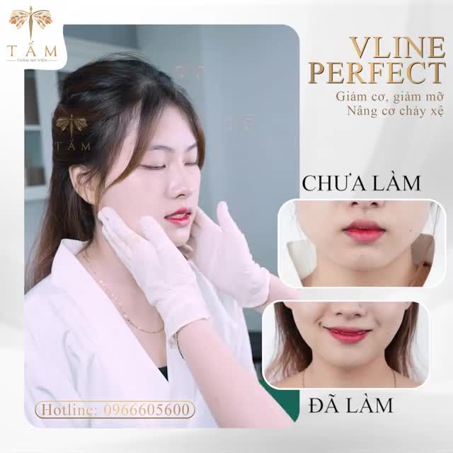 Khách hàng Khánh Linh đặt lịch đến Tấm tư vấn dịch vụ Vline Perfect