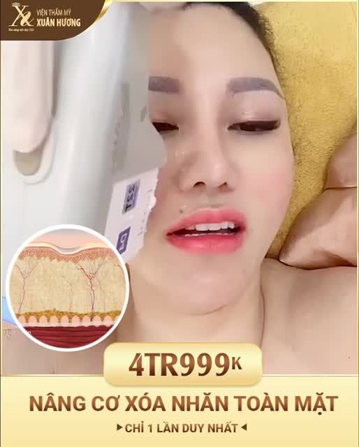 CHƯA TỪNG CÓ TẠI XUÂN HƯƠNG - tặng phái đẹp nâng cơ VGold Hifu chỉ còn 4999k cả mặt