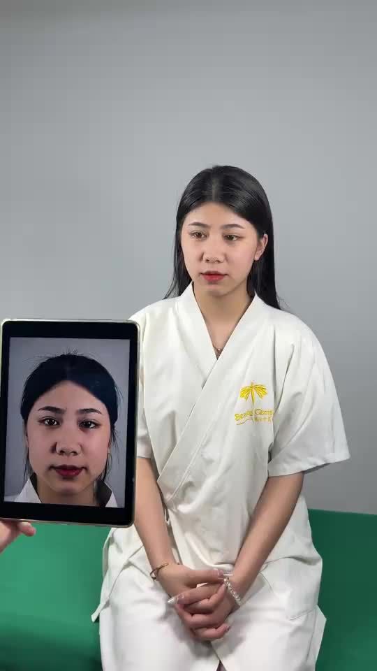 Chấm dứt khuyết điểm mặt vuông to khi sử dụng liệu trình thon gọn hàm của Tấm