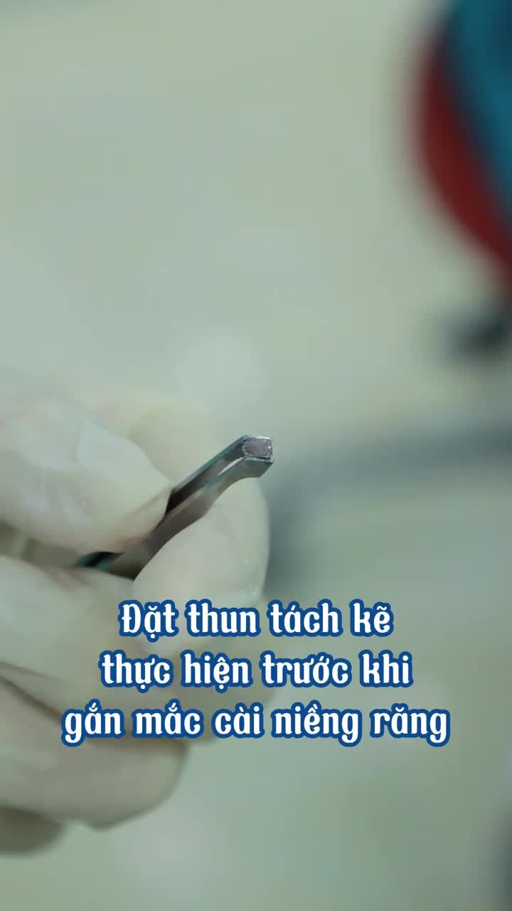 3 ĐIỀU CẦN LƯU Ý SAU KHI ĐẶT THUN TÁCH KẼ!