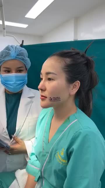COMBO Nâng mũi siêu cấu trúc + Độn cằm Vline Plasma  Kết quả sau 120 phút thực hiện