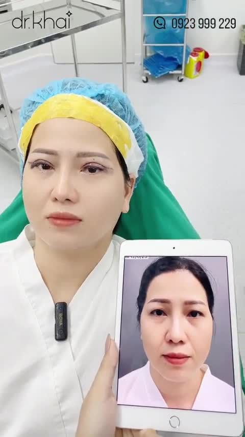 CẮT MÍ TRÊN ĐẸP QUÁ KHÁCH HÀNG ƠI