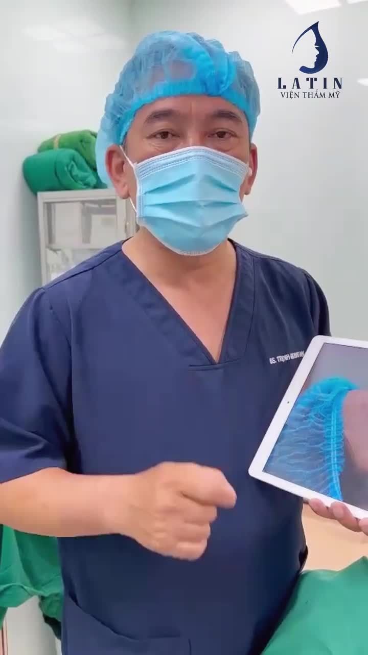 CHỈNH HÌNH DÁNG MŨI MỚI CHO EM GÁI LẦN ĐẦU TIÊN NÂNG MŨI