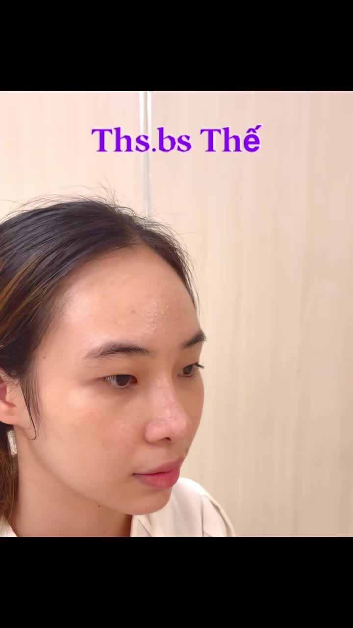 Nâng mũi thuận tự nhiên có thể là xu hướng tiếp theo tại Việt Nam.