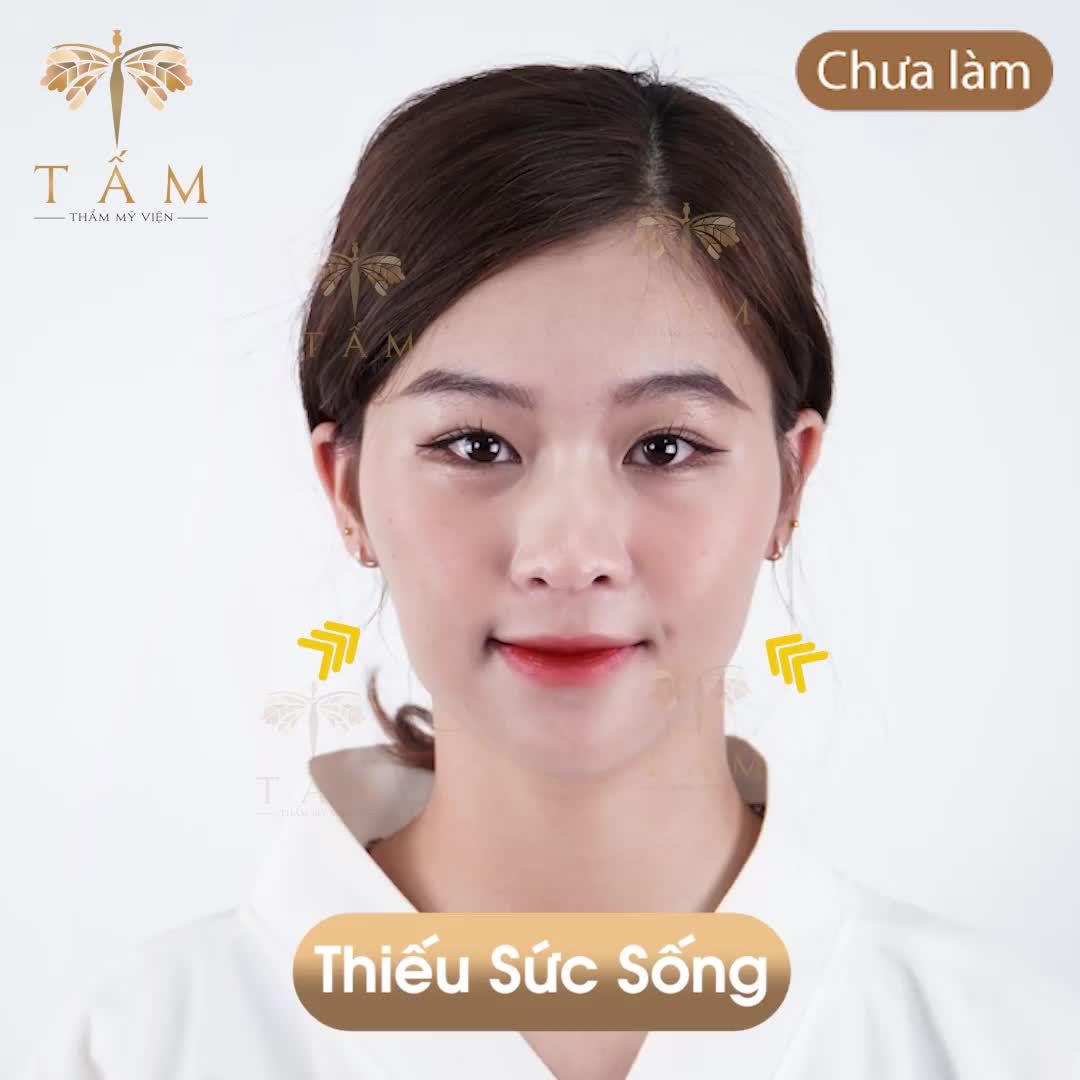 Khuôn mặt là tấm gương phản chiếu tâm hồn.