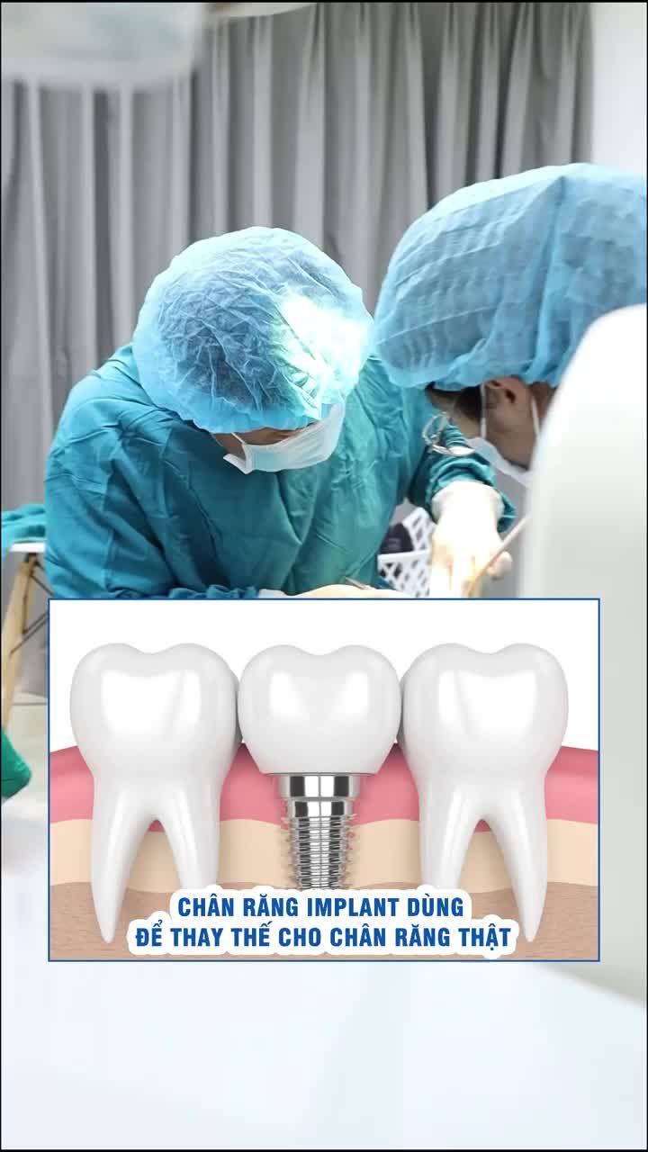 Cấy ghép răng Implant có giống như răng thật?