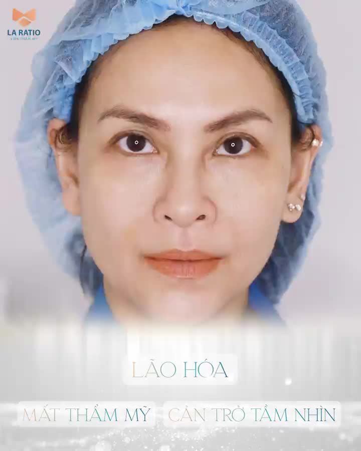 TREO MÀY TRẺ HÓA  “CỨU CÁNH” NÍU GIỮ THANH XUÂN
