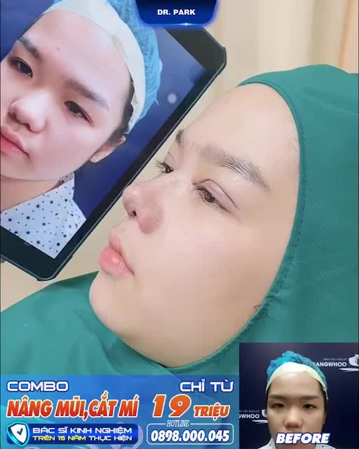 VẬY CÓ CÁCH GÌ ĐỂ LOẠI BỎ ĐƯỢC MỠ THỪA CƠ THỂ KHÔNG?