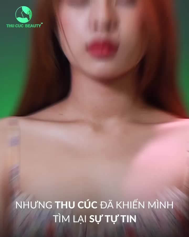 Chỉ với 15 phút Nâng ngực TC giúp bạn xoá bỏ tự ti vì vòng 1 teo lép