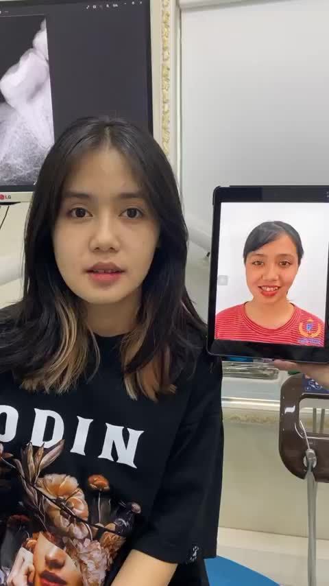 MẶT LỆCH NIỀNG RĂNG CÓ HẾT?