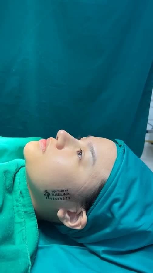 Case mũi cấu trúc vừa hoàn thành xong .