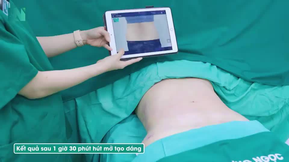 Video được quay trực tiếp ngay sau 2 giờ thực hiện hút mỡ tạo dáng thẩm mỹ.