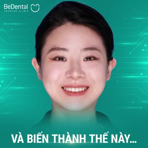 Ở 30 TUỔI CÓ NIỀNG RĂNG ĐƯỢC KHÔNG?