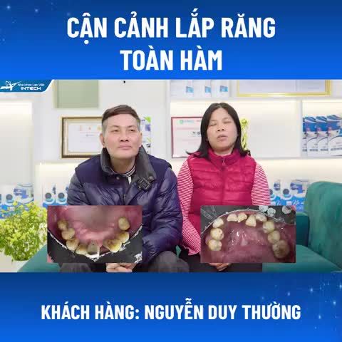 TRỒNG RĂNG IMPLANT XONG TÔI THẤY DIỆN MẠO MÌNH THAY ĐỔI HOÀN TOÀN