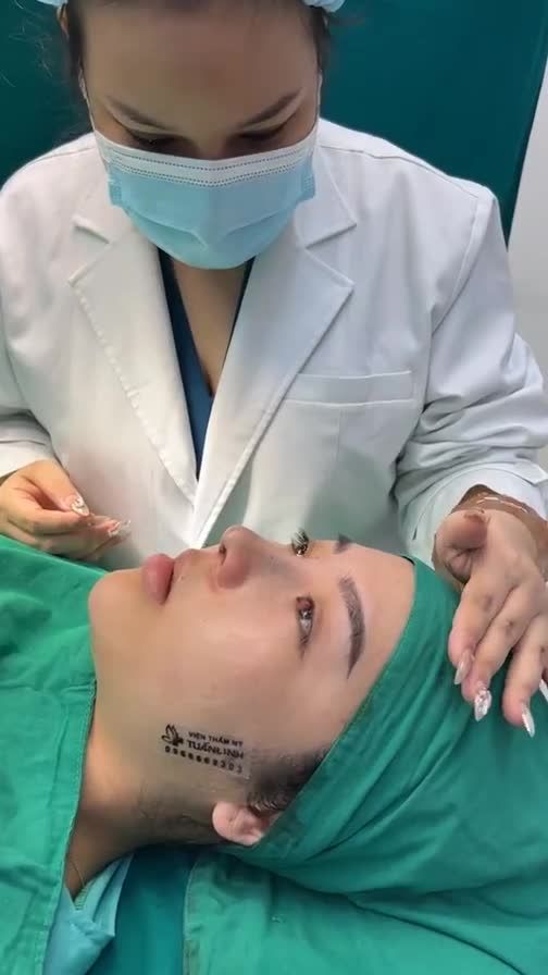 Case mũi cấu trúc surgiform vừa hoàn thành