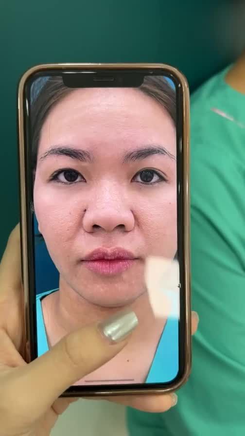 Case mũi cấu trúc vừa hoàn thành
