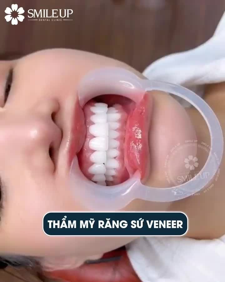 DÁN SỨ THẨM MỸ DÀNH CHO AI?