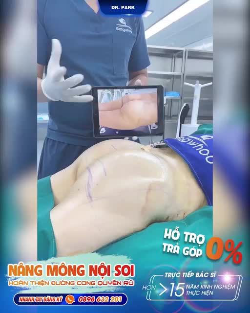 CHĂM SÓC SAU NÂNG MÔNG NỘI SOI NHƯ THẾ NÀO?