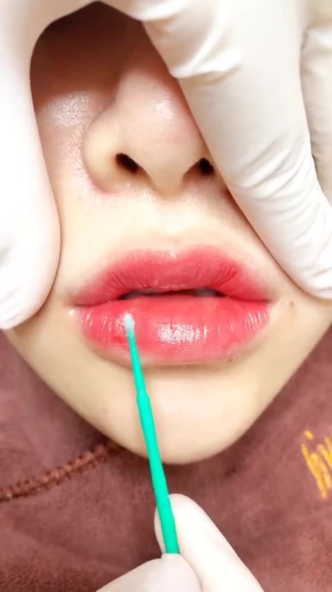 Môi xinh bong sau 36 tiếng