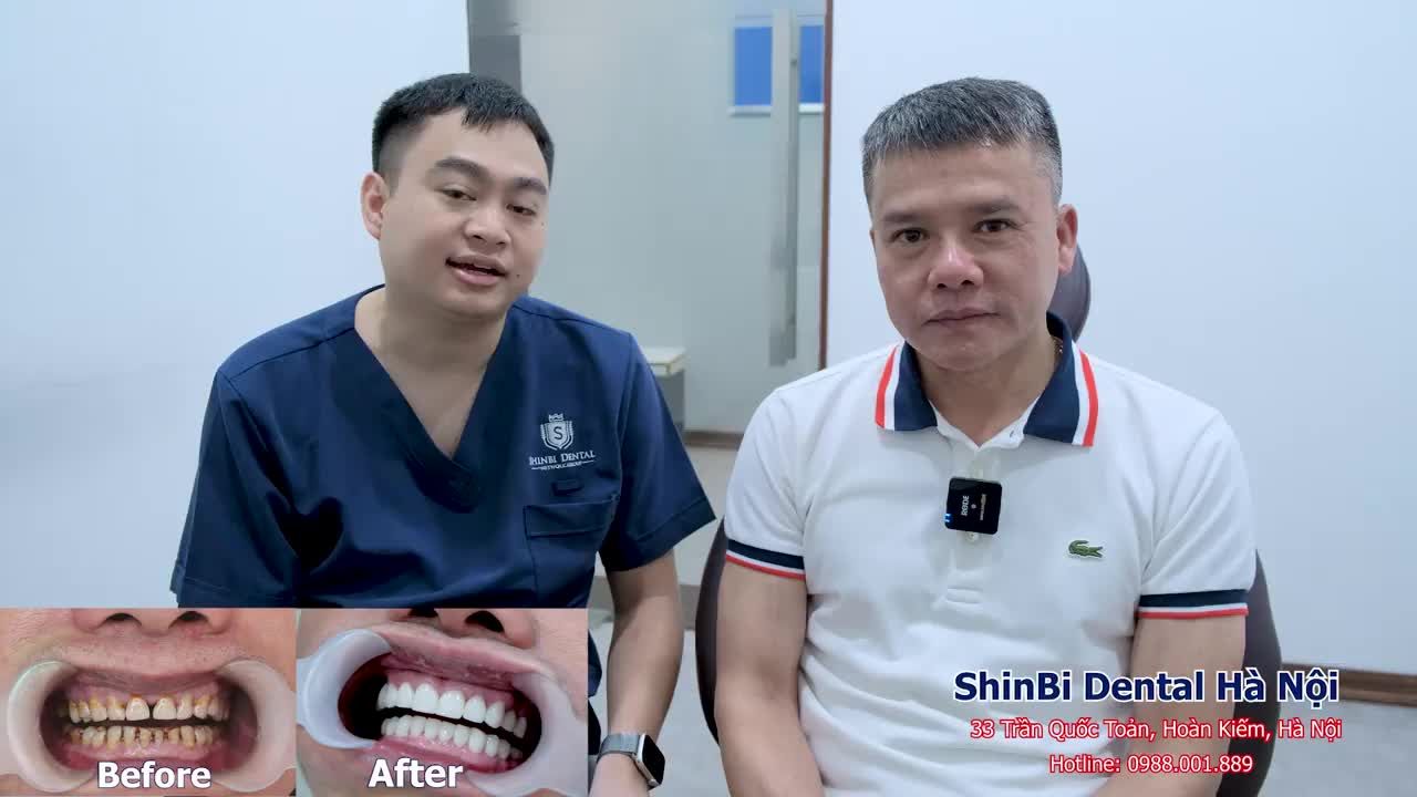 Combo: Răng sứ và Implant Liệu ăn nhai có được đảm bảo?