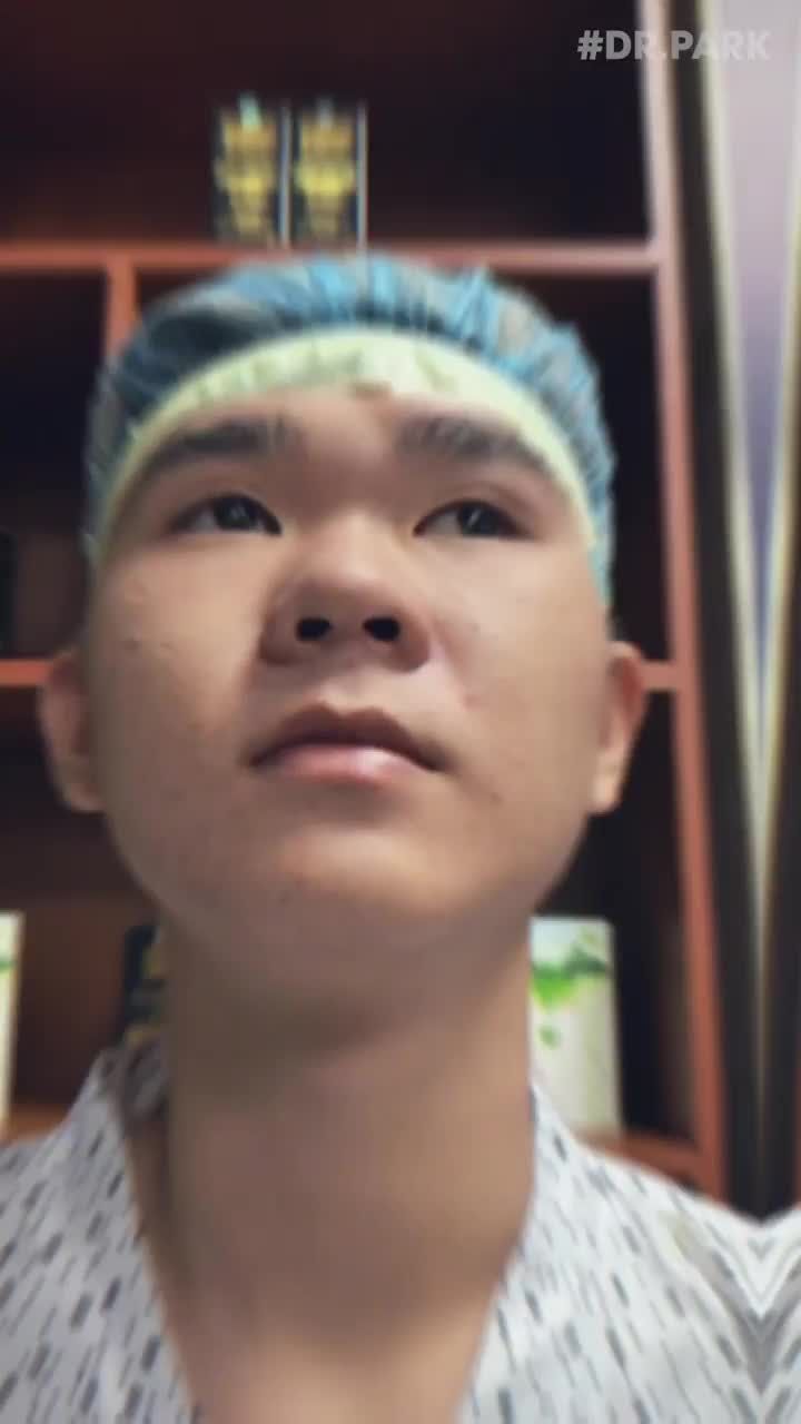 VÌ SAO NAM GIỚI NGÀY NAY THÍCH NÂNG MŨI?
