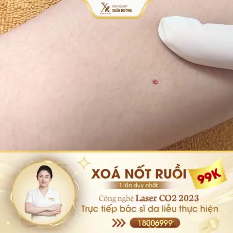Ơ KÌA, MỚI CHỈ 5S MÀ NỐT RUỒI ĐÃ BIẾN ĐÂU MẤT RỒI?