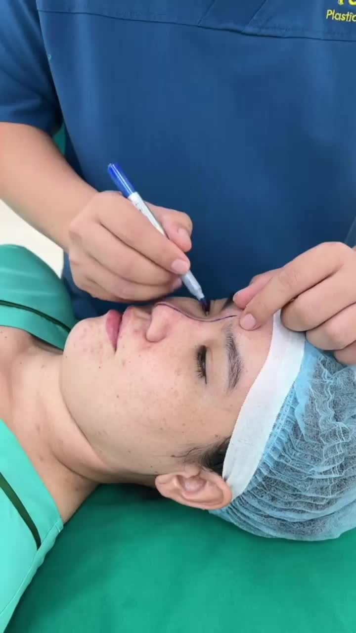 ?ú? độ?? ?ậ? ??ó? Khi xem gương và chứng kiến chiếc mũi mới thon đẹp, hài hòa của mình ngay sau phẫu thuật.