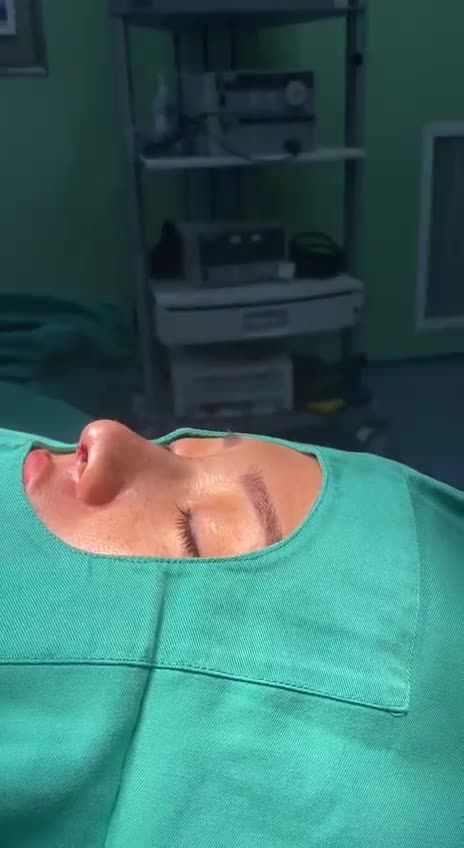NÂNG MŨI CẤU TRÚC ULTRA CELL HOÁ RA LÀ THẾ NÀY…