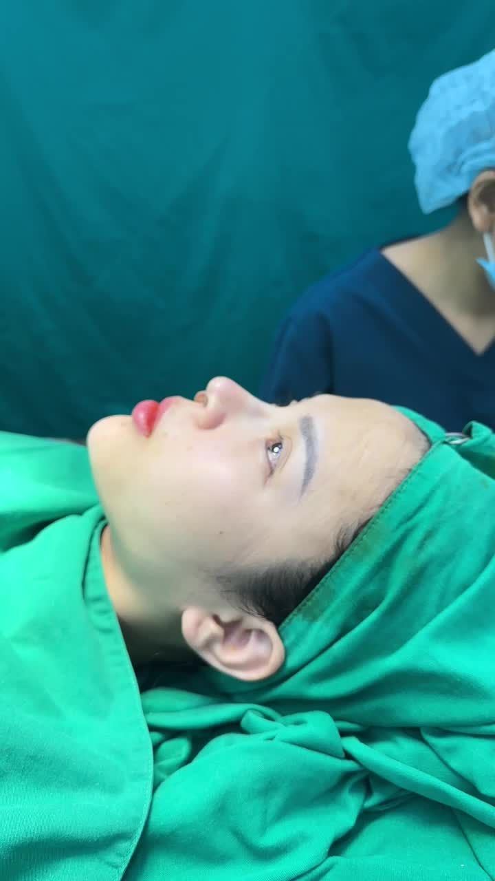 CASE MŨI CẤU TRÚC SURGIFORM CHO CÔ GÁI ĐẾN TỪ ĐU BAI