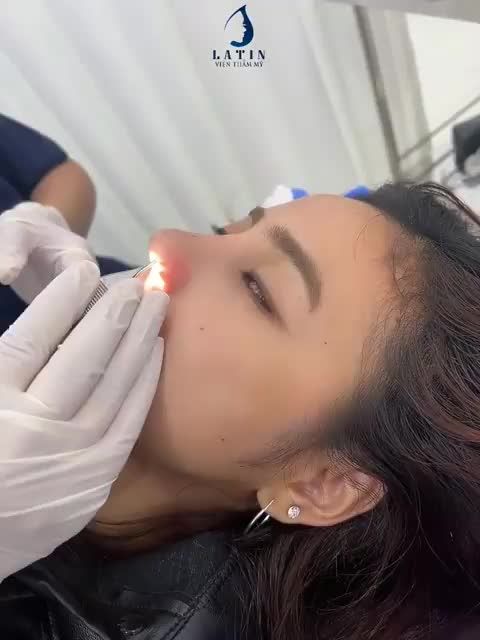 Combo mũi cằm xứng đáng có 10 người yêu