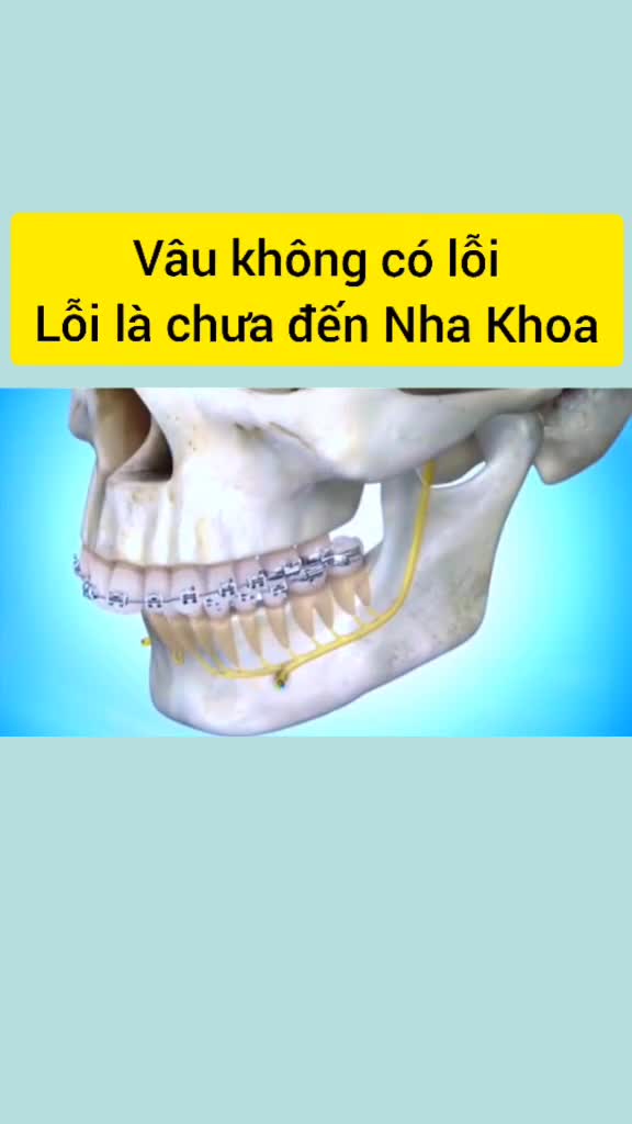 Vâu không có lỗi - lỗi là chưa đến Nha Khoa Jun Dental