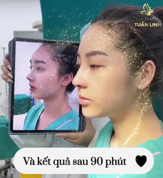 YÊU CẦU DÁNG MŨI NHƯ TRONG HÌNH...VÀ KẾT QUẢ!!