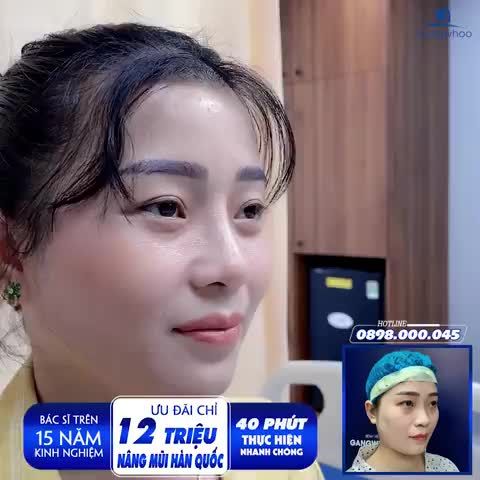 VÌ SAO NÂNG MŨI CẤU TRÚC ĐƯỢC MỆNH DANH LÀ VUA CÁC PHƯƠNG PHÁP NÂNG MŨI?