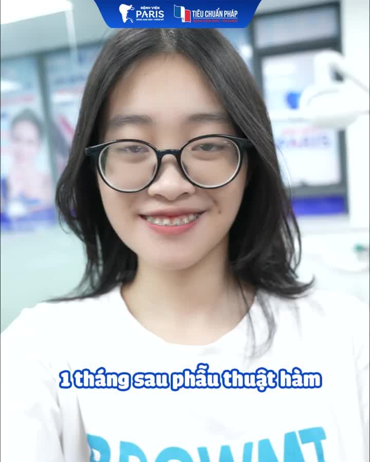 Chỉnh hàm móm xong xinh như vậy ai mà không mê