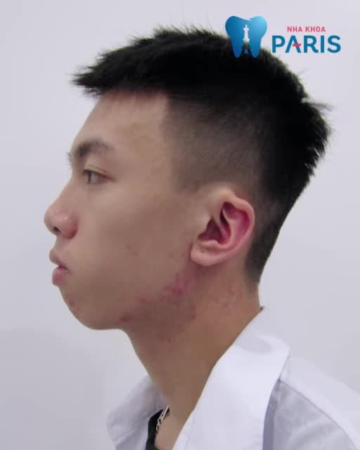 2 Năm Không Gặp Bạn Bè Không Nhận Ra