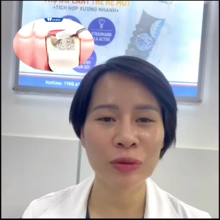 XƯƠNG NHÂN TẠO CÓ TÁC DỤNG NHƯ THẾ NÀO TRONG PHẪU THUẬT CẤY GHÉP CHÂN RĂNG NHÂN TẠO IMPLANT