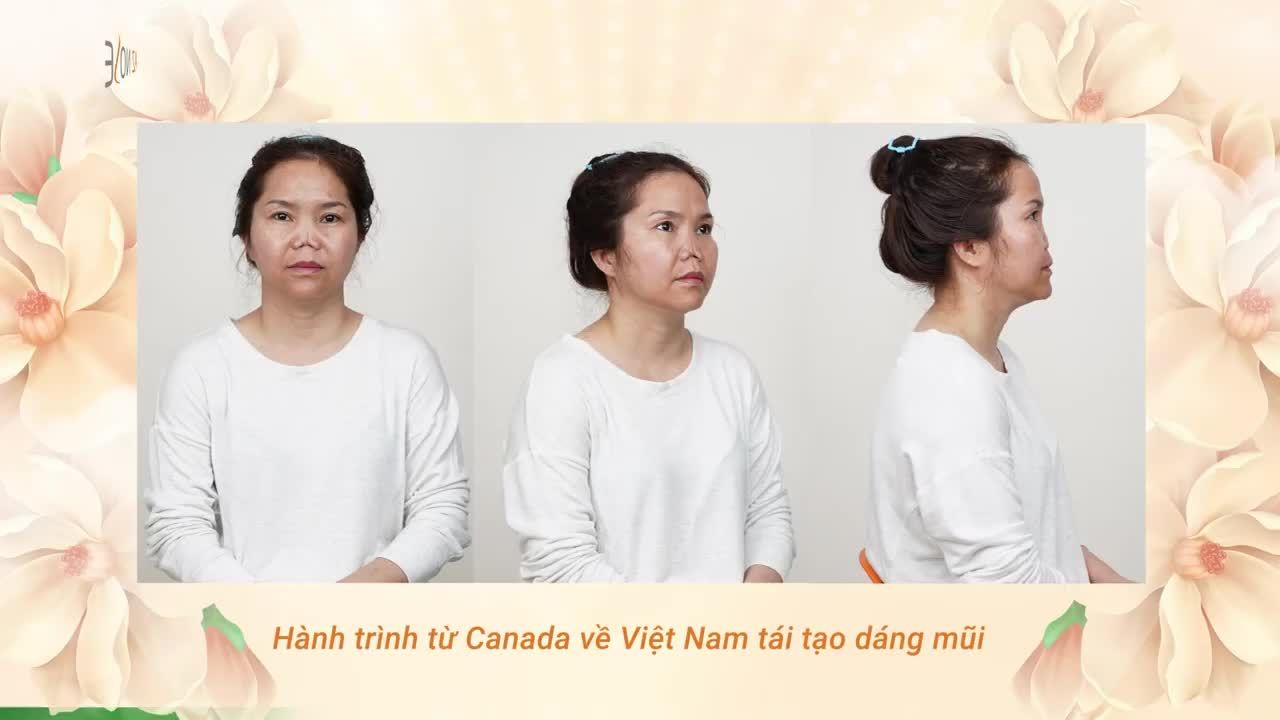 Hành trình tìm lại chiếc mũi "bình thường" của khách hàng đến từ Canada