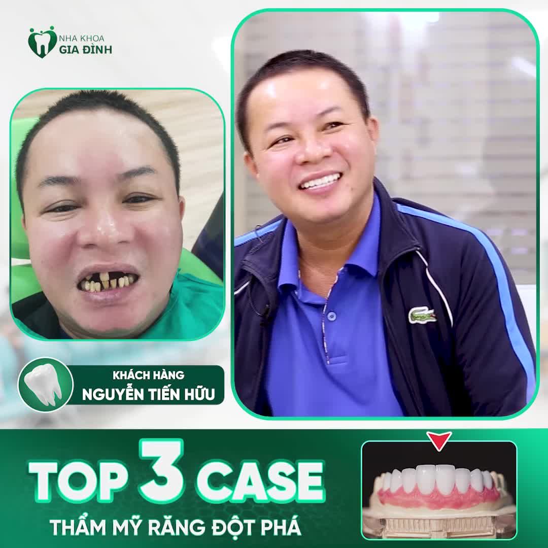 TOP 3 KHÁCH HÀNG THAY ĐỔI NỤ CƯỜI MỘT CÁCH NGOẠN MỤC