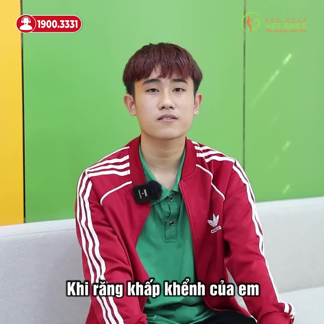 REVIEW SAU 1 NĂM NIỀNG RĂNG TẠI VIET SMILE