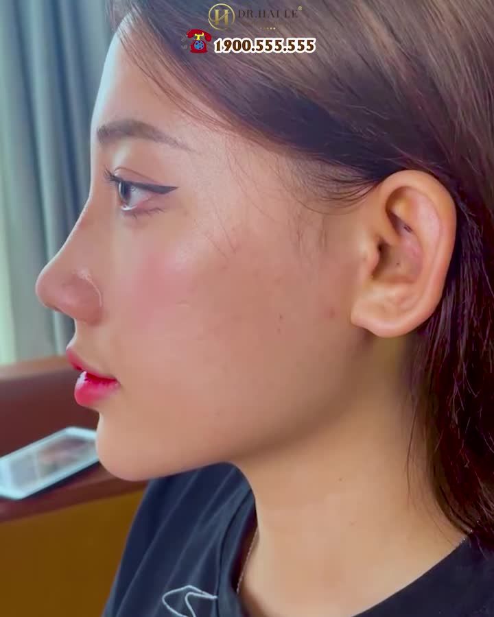 Dáng mũi gồ, đầu mũi hếch ảnh hưởng đến nhiều khía cạnh cuộc sống: Luôn tự ti, tình duyên chẳng như ý, tài lộc hao tổn