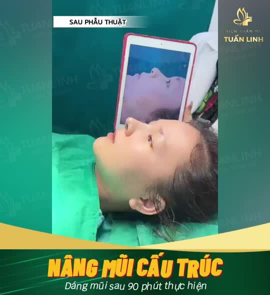 Mũi cao bay - Mặt sắc nét - Xinh đẹp mọi góc nhìn!!