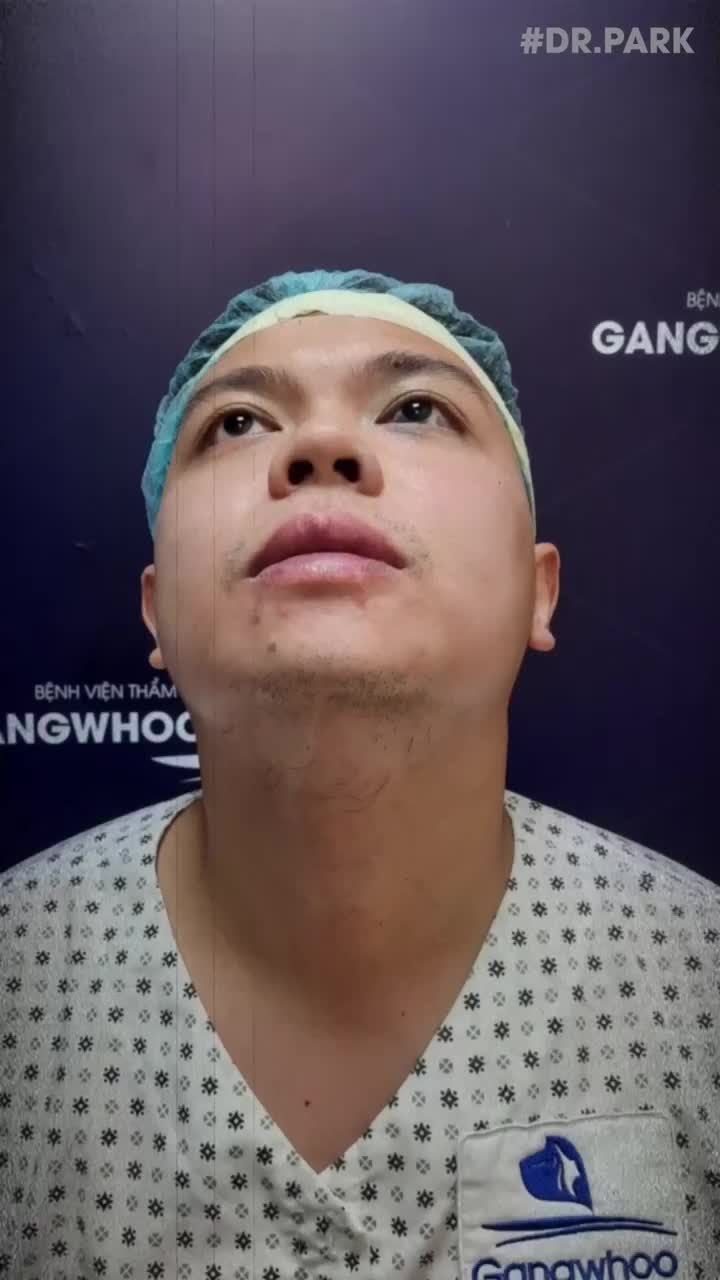 ƯU ĐIỂM NỔI BẬT CỦA NÂNG MŨI BỌC SỤN TAI?