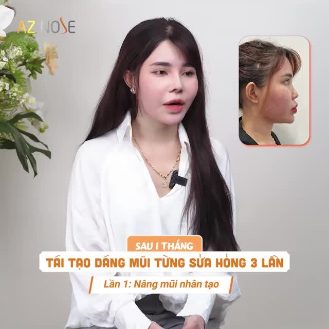 Phải đi xa "ở ẩn" đến 1 năm, chị K.P. đã vượt qua giai đoạn mũi bị h.ỏng như thế nào? Theo dõi câu chuyện ngay sau đây.