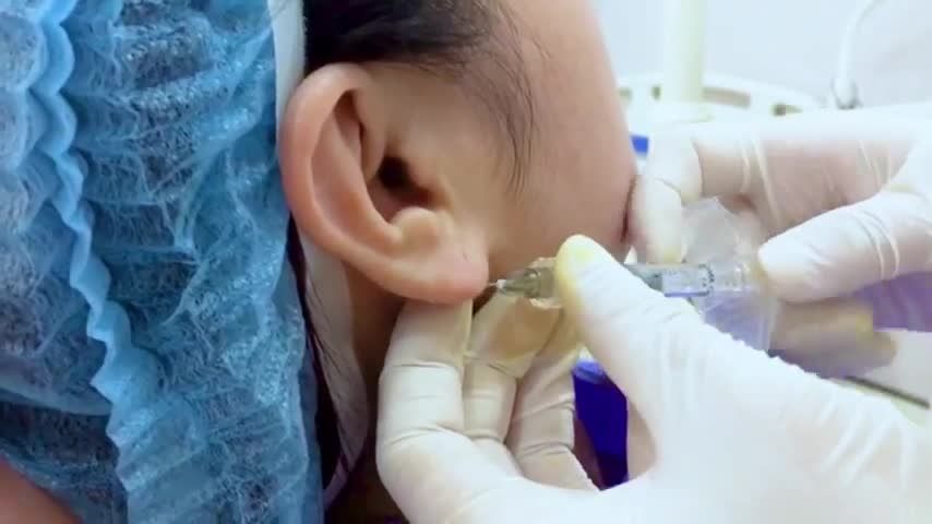 Tạo hình tai tài lộc giúp bạn sở hữu đôi tai đầy đặn phát lộc như thế nào? Cả nhà cùng theo dõi