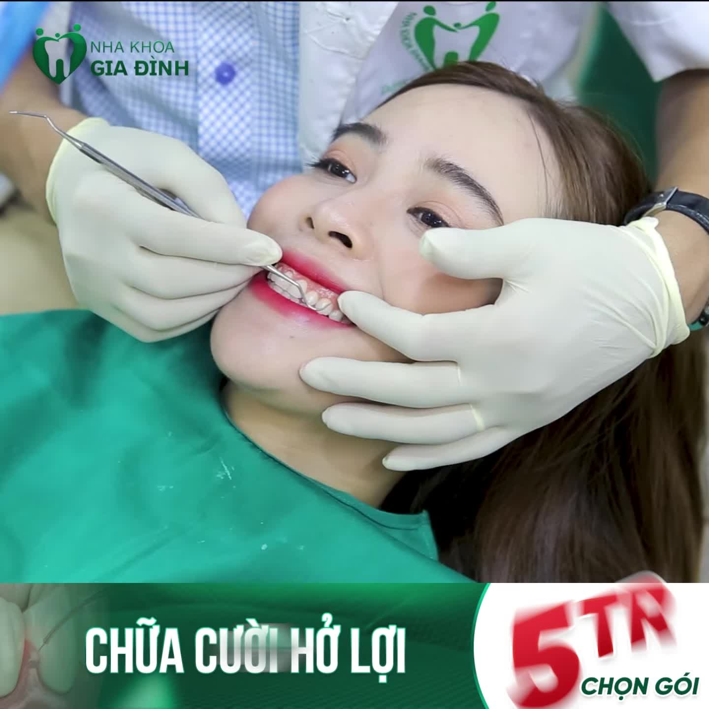 KHẮC PHỤC NGAY CƯỜI HỞ LỢI TRỌN ĐỜI - ĐẢM BẢO KHÔNG TÁI PHÁT