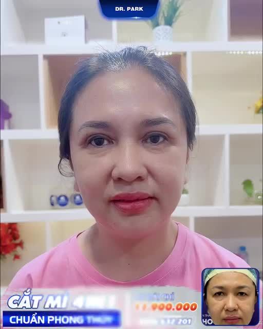 MUỐN MẮT HAI MÍ TO TRÒN - CHỌN NGAY CẮT MÍ 4 IN1